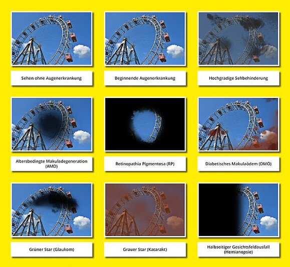 Augenerkrankungen aus Sicht von Patientinnen und Patienten Plakat mit dem Titel "Augenerkrankungen". Einzelne Fotos wie man mit einer bestimmten Augenerkrakung sieht.